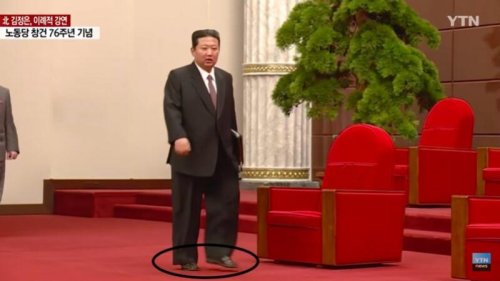 朝鲜领导人金正恩10日在劳动党76周年党庆发表演说。这次吸睛的是金正恩身穿西装，脚上却搭配一双凉鞋。引发外界揣测。